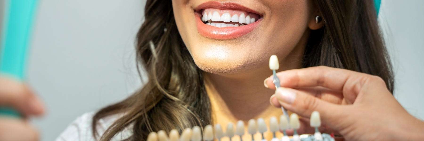 Crowns and Bridges | Dentist